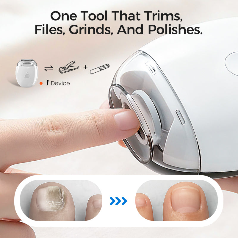 Electric Automatic Nail Clipper & Trimmer - Safety for the elderly and children