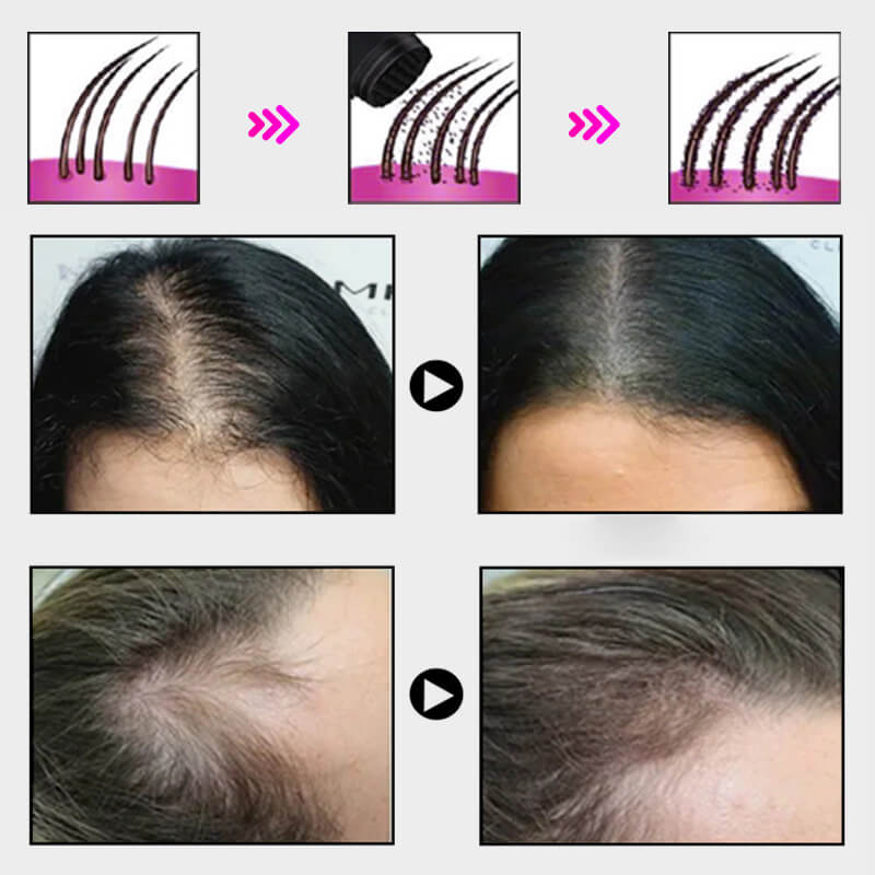 🔥BUY MORE SAVE MORE💝Hair Thickening Hair Building Fiber Powder