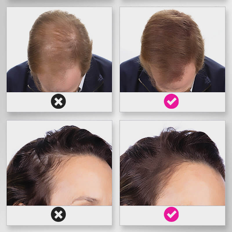 🔥BUY MORE SAVE MORE💝Hair Thickening Hair Building Fiber Powder