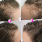 🔥BUY MORE SAVE MORE💝Hair Thickening Hair Building Fiber Powder