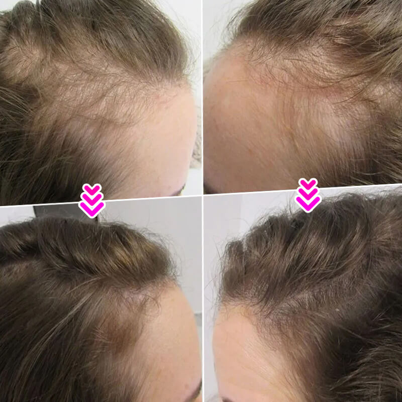 🔥BUY MORE SAVE MORE💝Hair Thickening Hair Building Fiber Powder