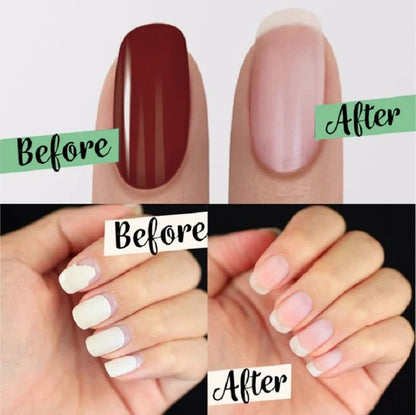 🌿🛡️ 50% OFF! Magic Gel Remover – Fast‑acting, gentle on nails. Break down gel polish instantly