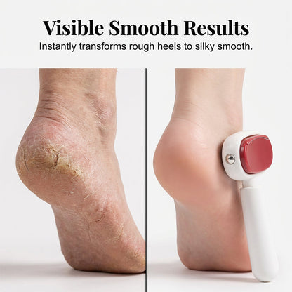 🏆 50% OFF NOW! 🦶 Double-Sided Foot Scraper – Removes calluses & dead skin easily – For smooth, baby-soft feet at home ✨