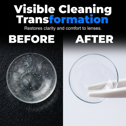 Ultrasonic Contact Lens Cleaner Case