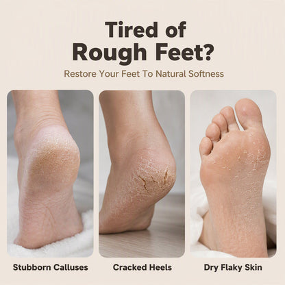 🥳HOT SALE🥳💞10K+ SOLD! Foot Remover ! 3-in-1, nano glass & dual speed. Soft, smooth feet – grab yours! ✅