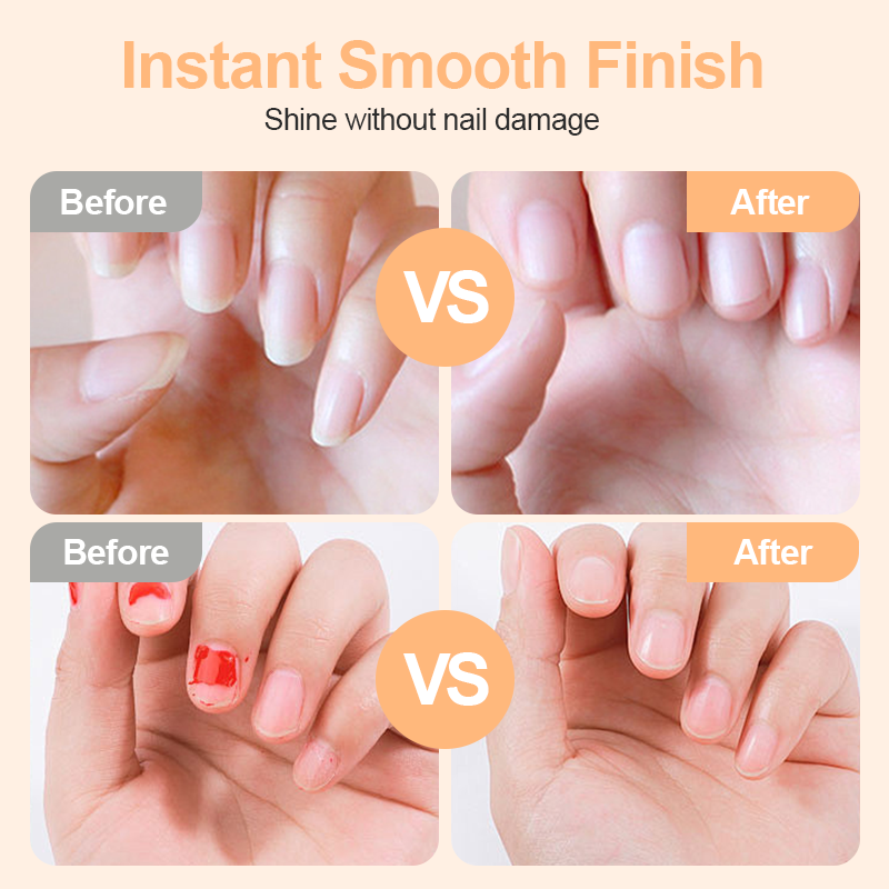 ⏳🔥LIMITED-TIME 50% OFF! ⏰: 2-in-1 Safe Electric Nail Clipper——Manicure + Nail Care—for even more beautiful nails.
